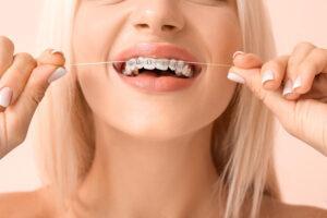 A person demonstrating the proper technique for brushing teeth with braces, focusing on cleaning around brackets and wires for effective oral hygiene