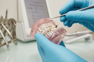 Braces service in Queens