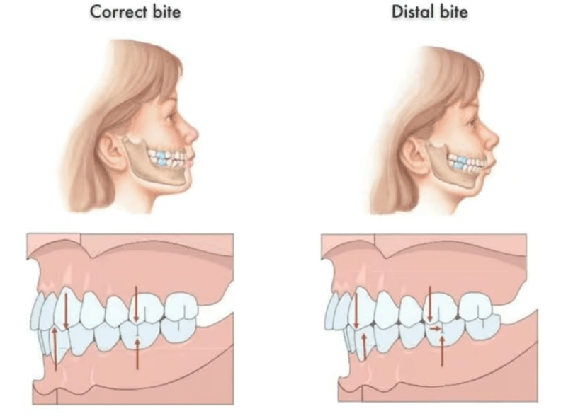 The link between a correct bite and overall well-being